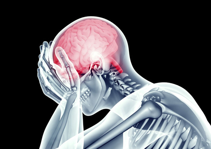 skeleton holding his head